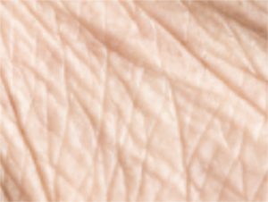 Facial Contouring Fillers Lebanon