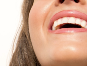 Facial Contouring Fillers Lebanon