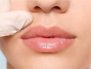 Facial Contouring Fillers Lebanon