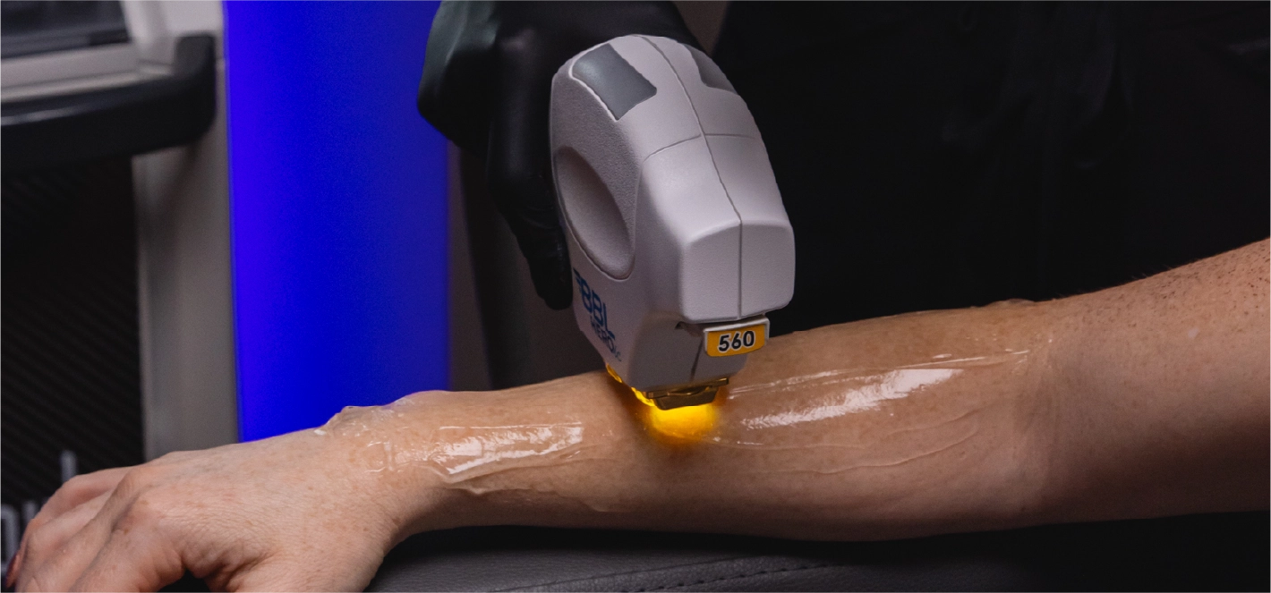 Forever Young Laser Treatment Lebanon